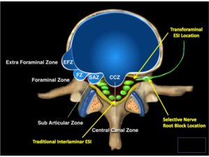 ventral epidural space