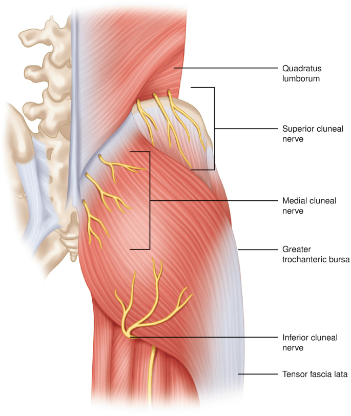 Superior Cluneal Neuropathy