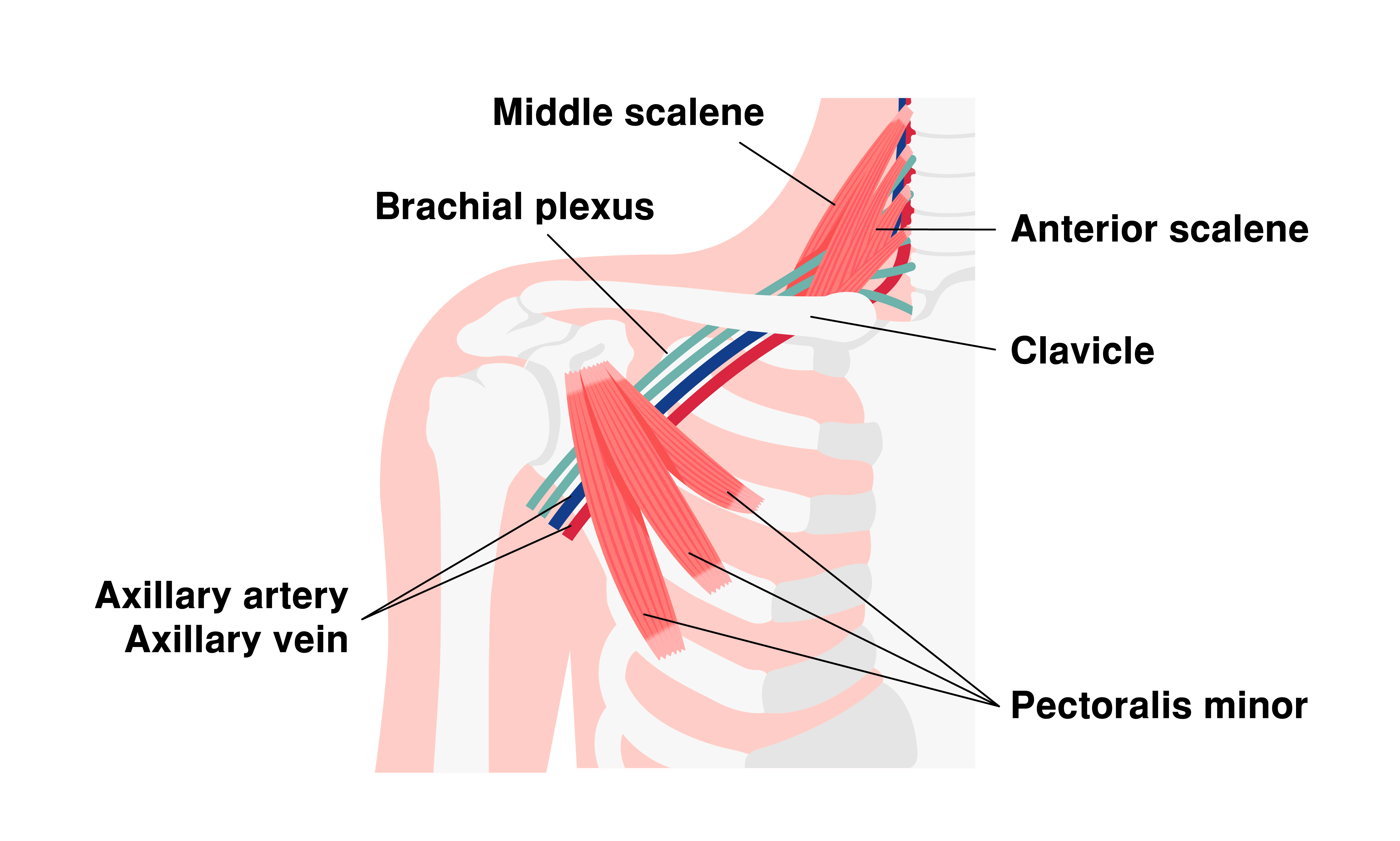 Thoracic Outlet Syndrome