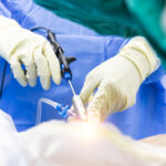 Medial-Branch-Neurectomy-vs-RFA