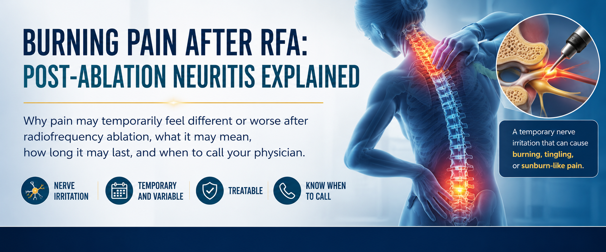 Burning Pain After RFA: Post-Ablation Neuritis Explained