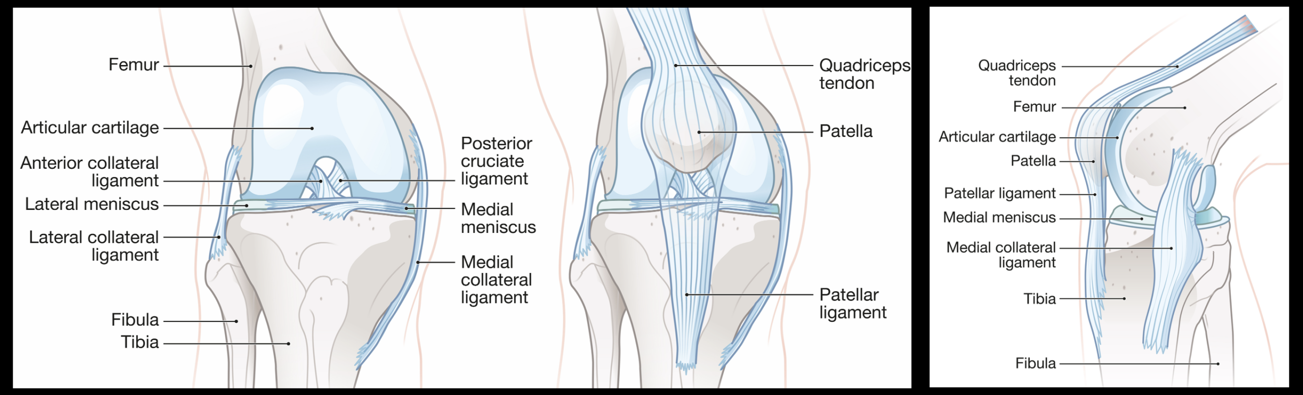 Detailed anatomical illustration of the knee showing the femur, tibia, fibula, patella, quadriceps tendon, menisci, and major stabilizing ligaments.
