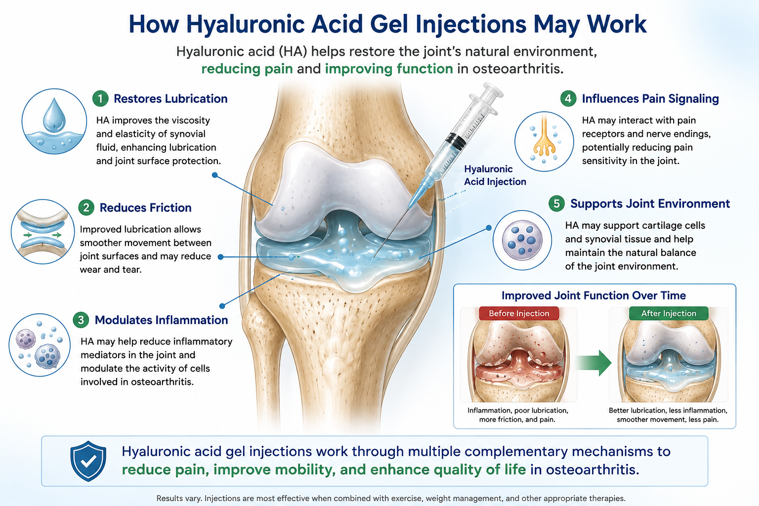 Educational medical illustration showing how a hyaluronic acid injection may improve joint lubrication, reduce friction, and influence inflammation and pain signaling.