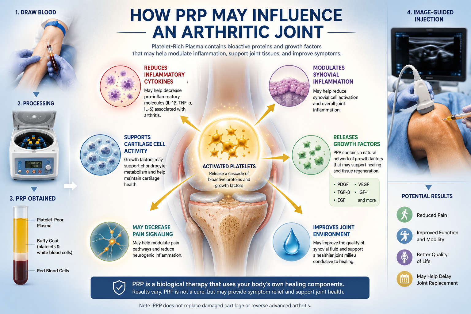 Medical infographic showing activated platelets releasing growth factors that may influence inflammation, synovial tissue, cartilage cells, and pain signaling within an arthritic joint.