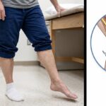 Lumbar Radiculopathy vs Peroneal Neuropathy