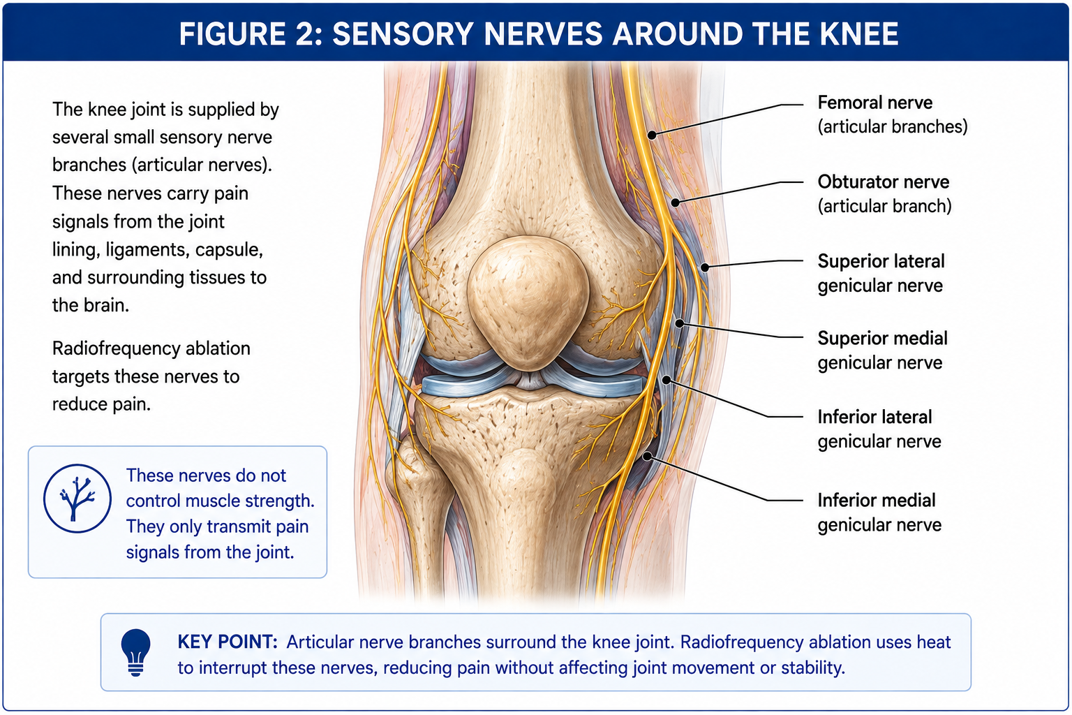 Anterior knee anatomy showing sensory articular nerve branches, including genicular nerve targets involved in transmitting chronic knee pain.