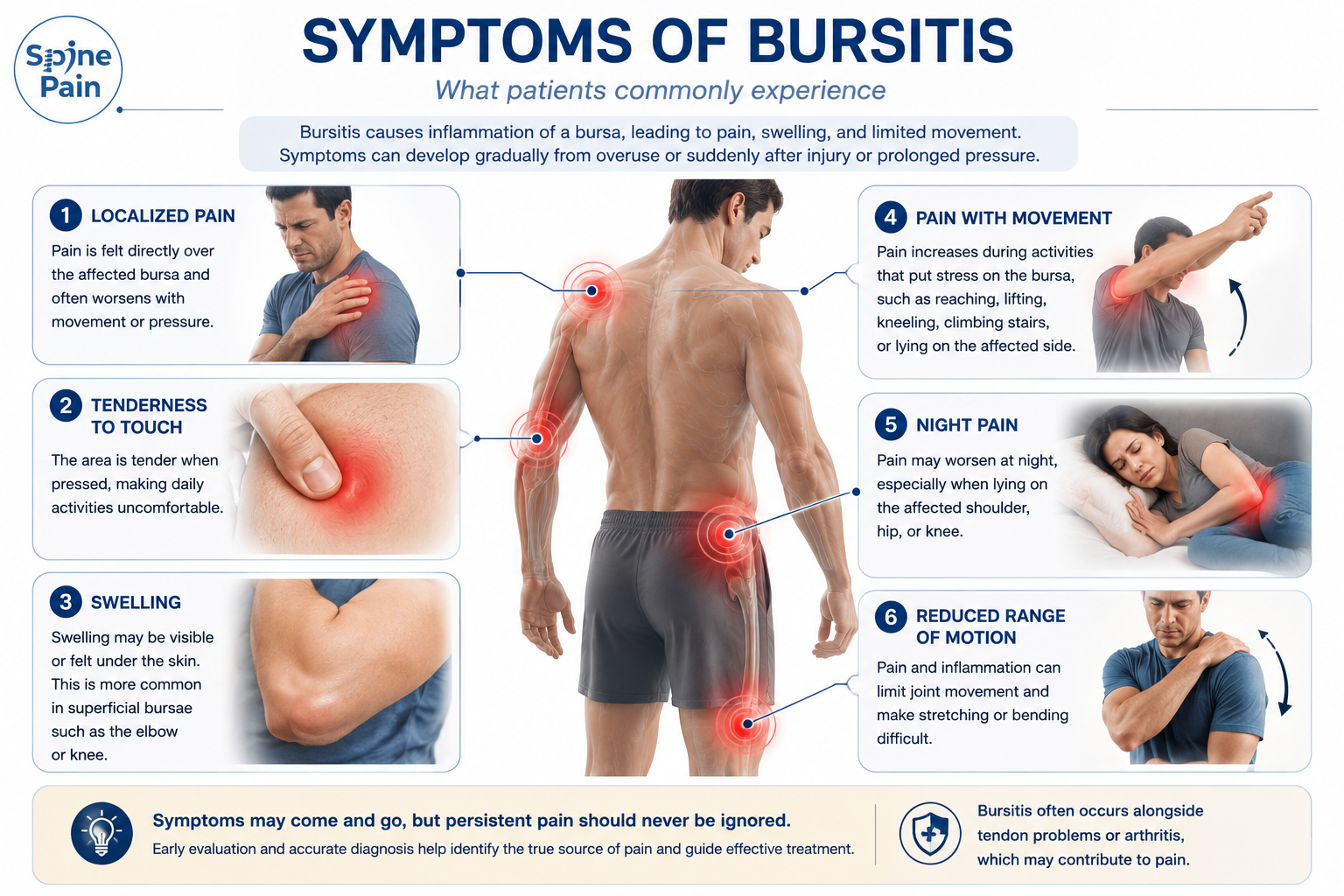 Educational infographic illustrating the common symptoms of bursitis, including localized pain, tenderness to touch, swelling, pain with movement, night pain, and reduced range of motion.