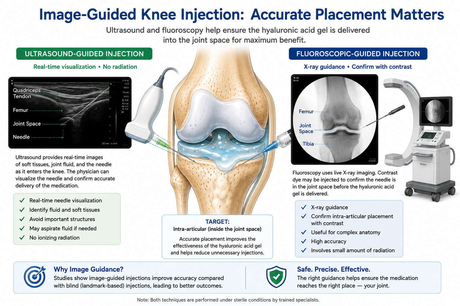 Educational medical illustration comparing ultrasound-guided and fluoroscopic PRP injection techniques for accurate placement within an arthritic knee joint.
