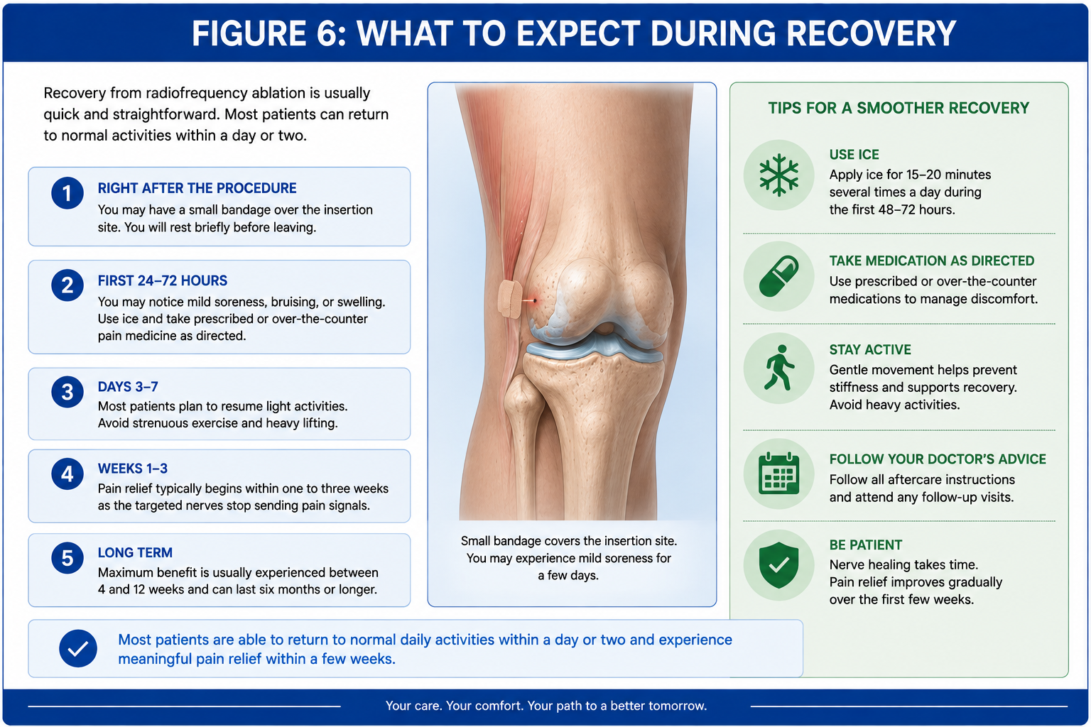 Recovery timeline after joint radiofrequency ablation showing early soreness, return to light activity, gradual pain relief, aftercare instructions, and expected long-term improvement.